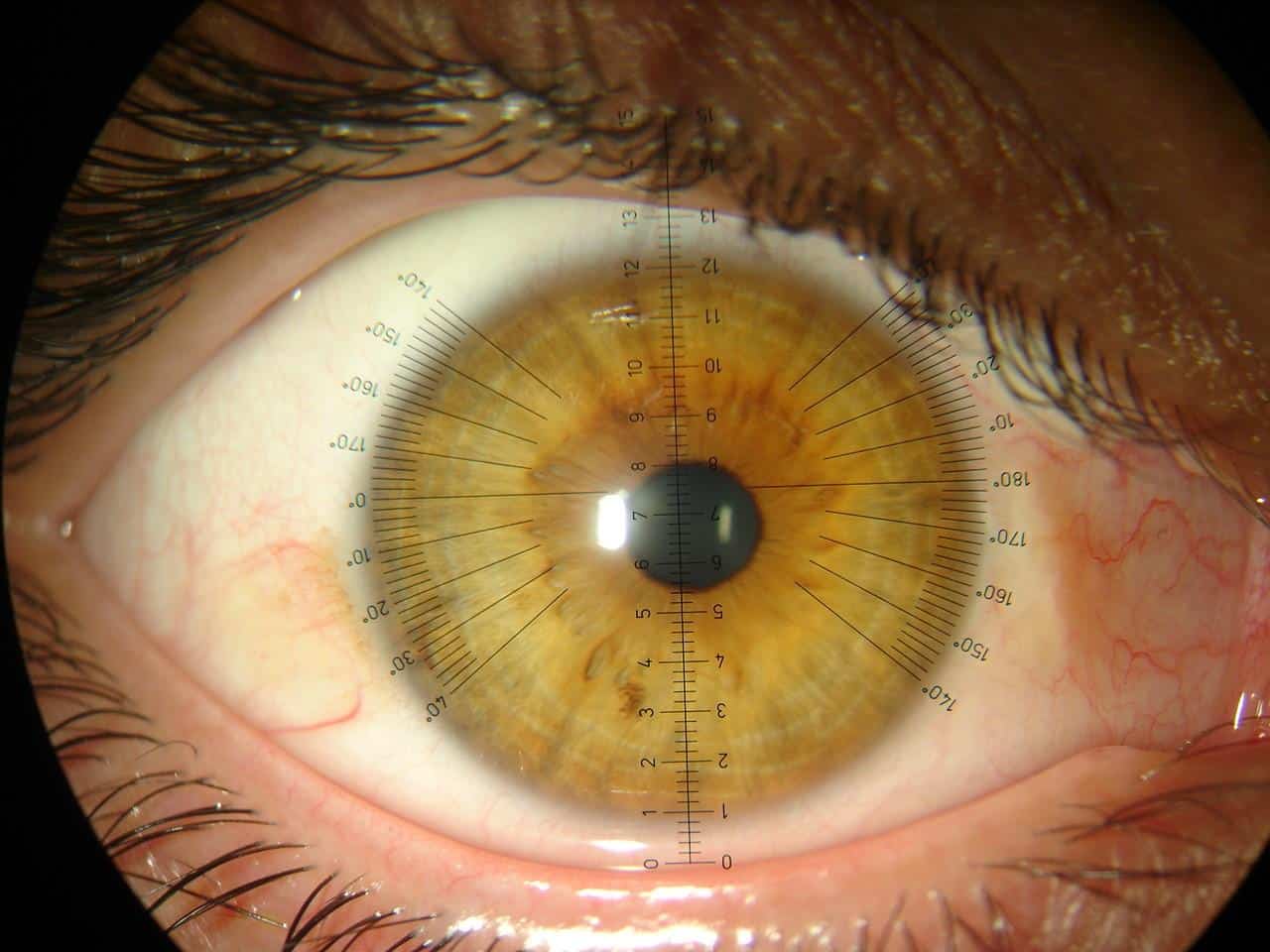 Braga. Lentes reduzem 59% da miopia nas crianças
